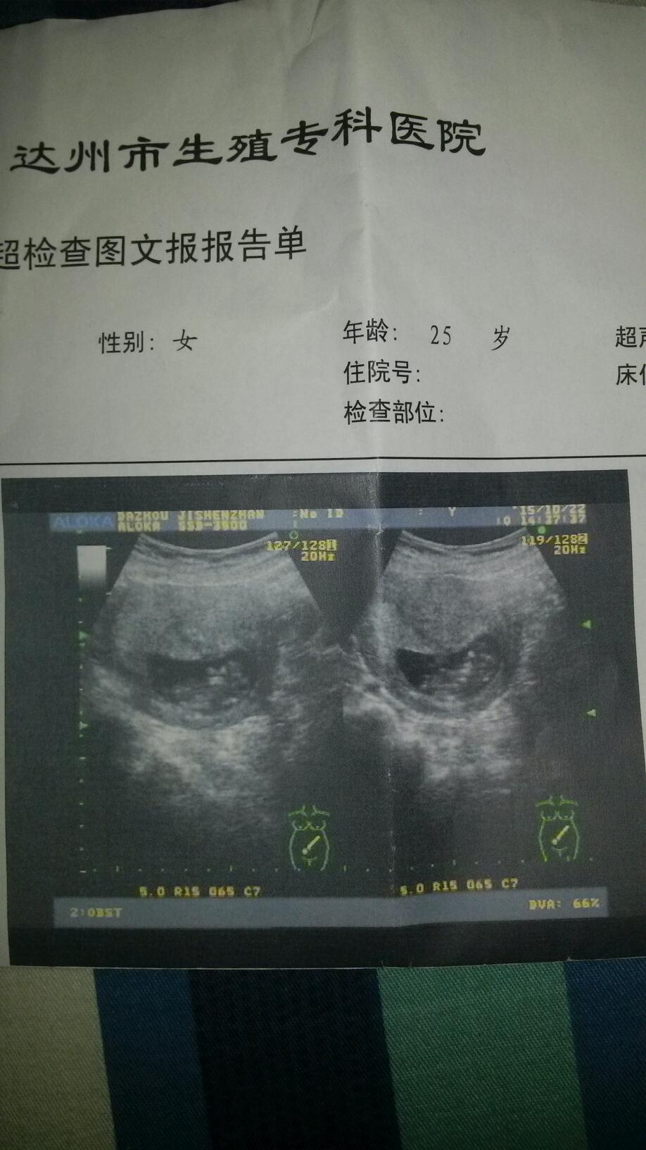 10周时做的b超,医生说快发育成小人了