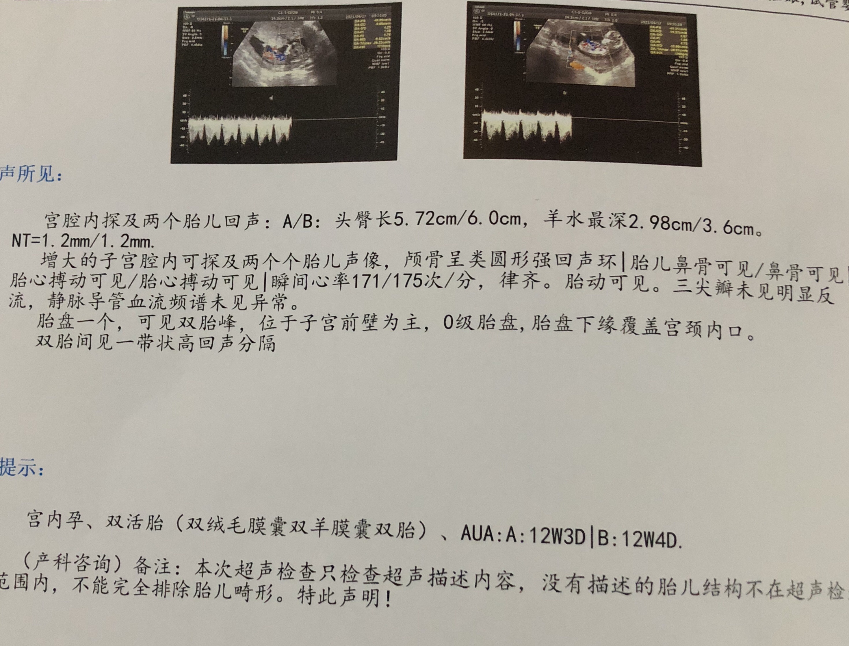 nt顺利通过已知男宝