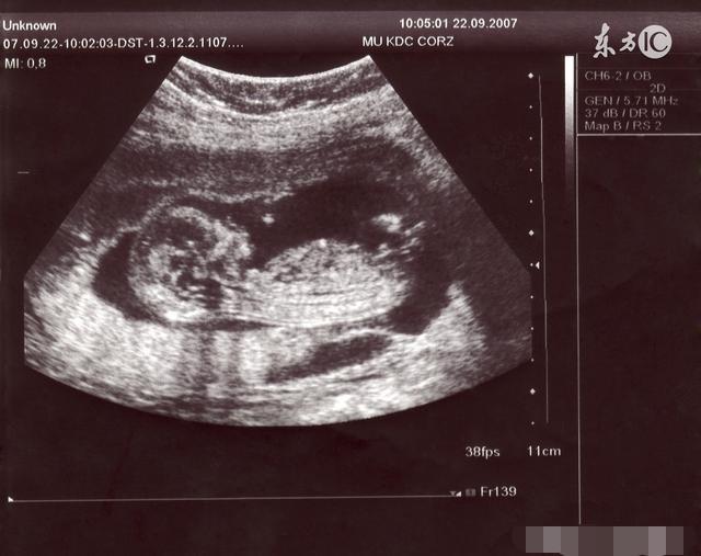 怀孕后期生男孩的症状,生过的宝妈都说准