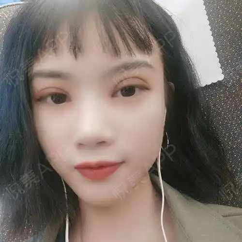 【长沙伊美双眼皮】阳光明媚的假期和旅游更配哦!