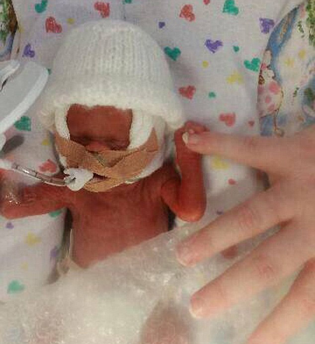 唐纳利(lynn donnelly)生下了一对双胞胎儿子,两个小婴儿加起来只有3