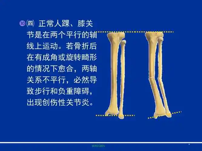 胫腓骨骨折急诊处理ppt参考幻灯片