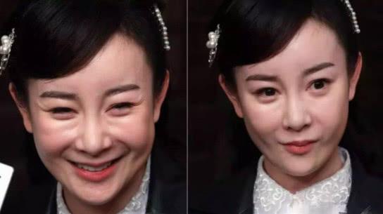 8位整容变毁容的女明星以前美貌动人现在僵硬成网红1