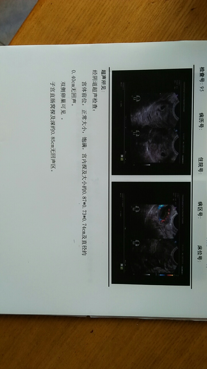 帮我看看这张b超图怀孕45天,正常吗?今天刚做的