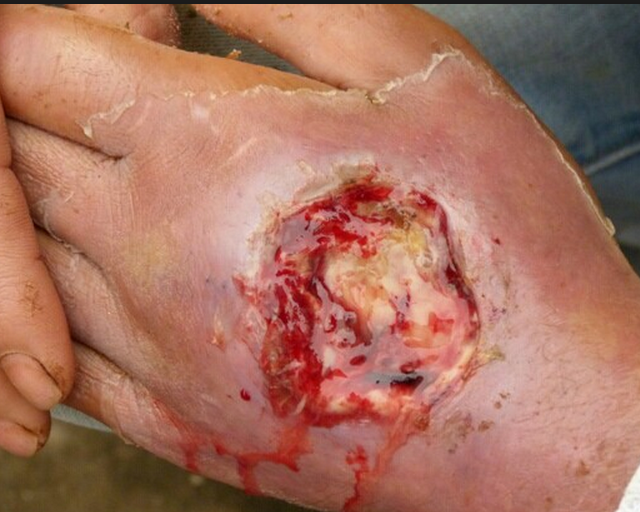 眼镜蛇毒杀无数生物但它咬到自己同样会中毒身亡