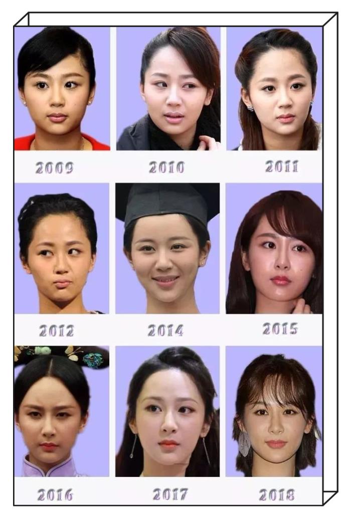 杨紫整容了吗杨紫整容史