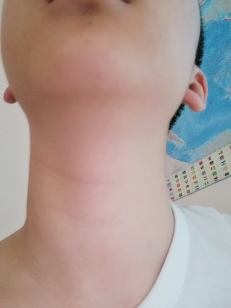 男生喉结长成这样正常吗