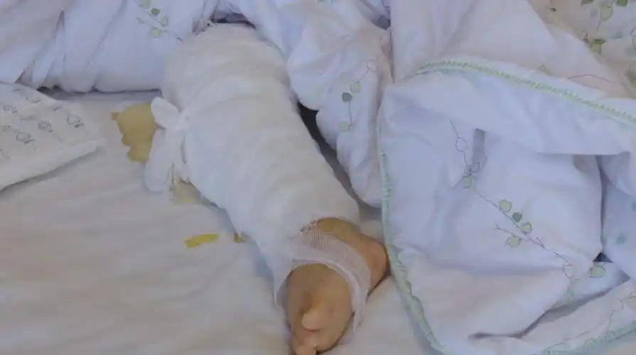 昨天,一位孩子的母亲给我们打电话求助,说她4岁的女儿发生了交通事故