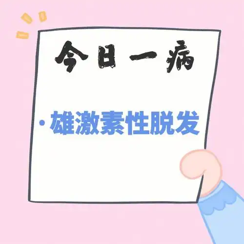 雄激素性脱发脂溢性脱发