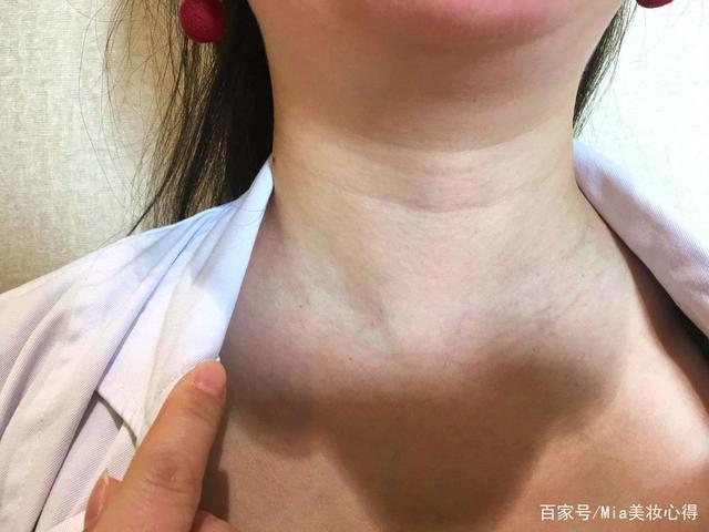 女人脖子出现"三条杠",你知道表示什么吗?别傻傻不在意