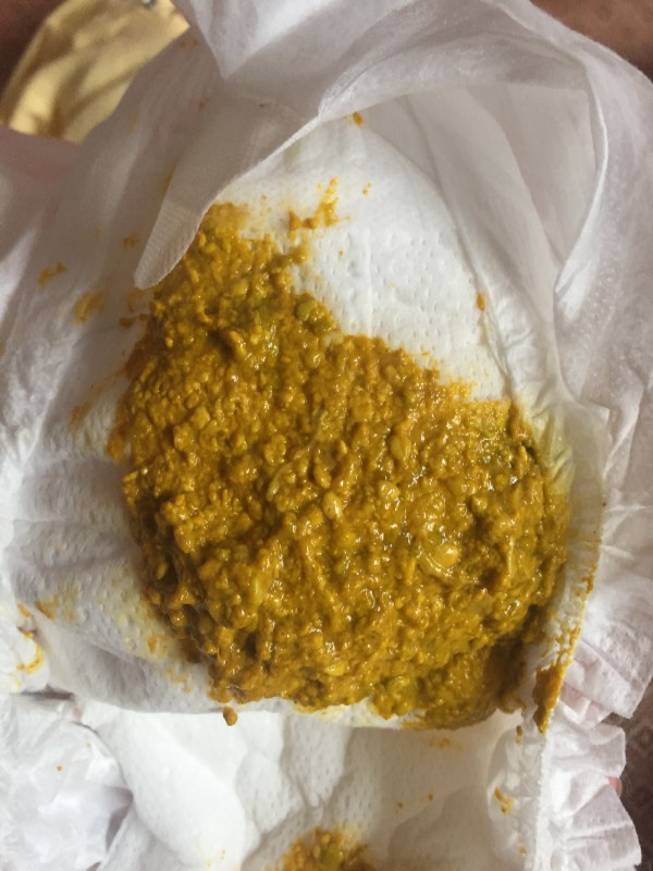 两个月小宝宝拉这样的粑粑正常吗