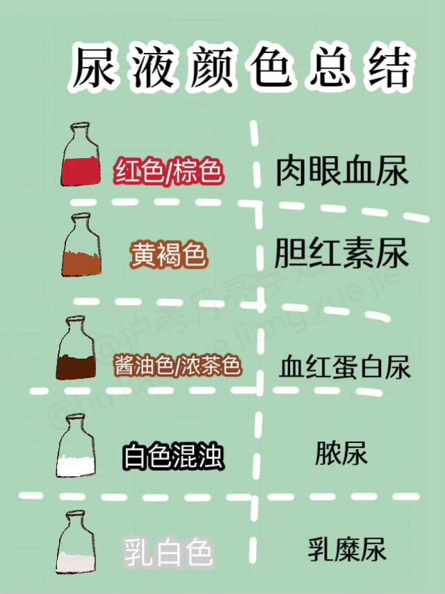 护考考点尿液颜色 7815 月亮不睡我不睡 考试中常常会考的尿液