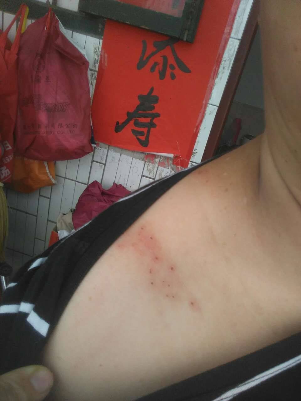 21天之第17天-乳腺癌康复圈-觅健