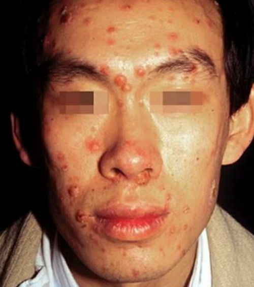 这样的表现就是常说的肝病面容图片