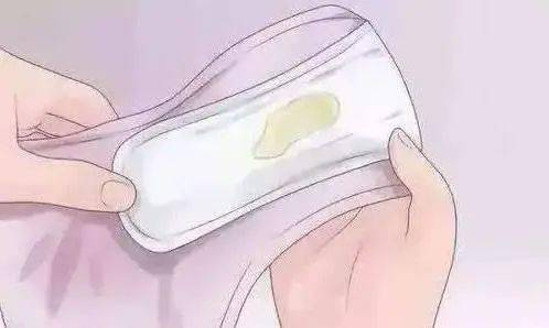 01,白色分泌物在经期开始或结束时,出现一点白色或乳白色分泌物是正常