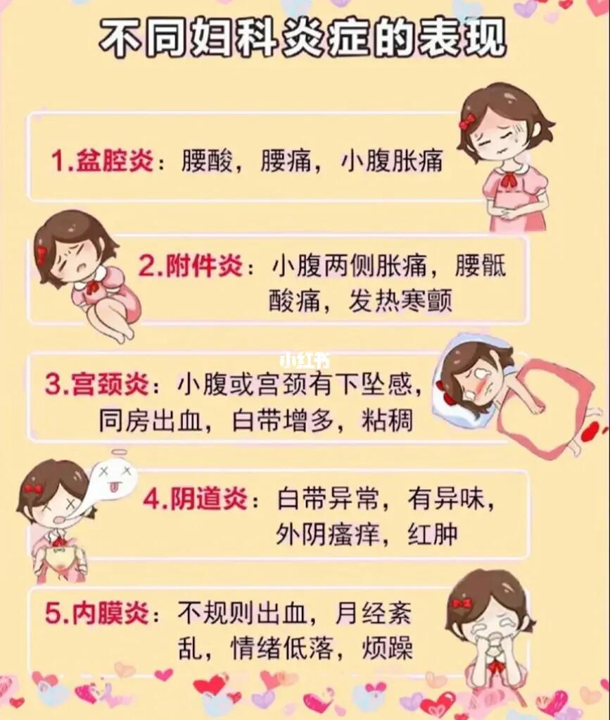 妇科炎症_女性健康_科普_医疗健康_医疗健康其他