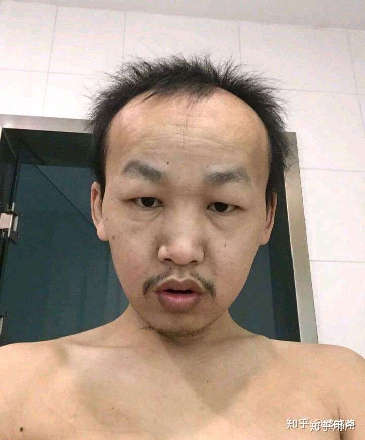 有没有长得丑的男生照片分享一下.我想知道什么样算丑 ?