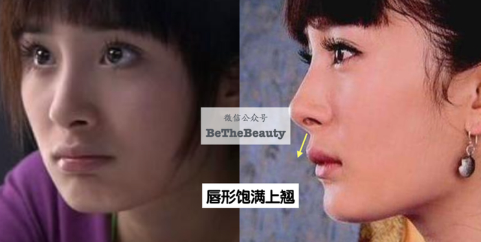 杨幂原来嘴唇也符合这个,所以即使骨骼上有点瘪,整体不显但一旦大幅