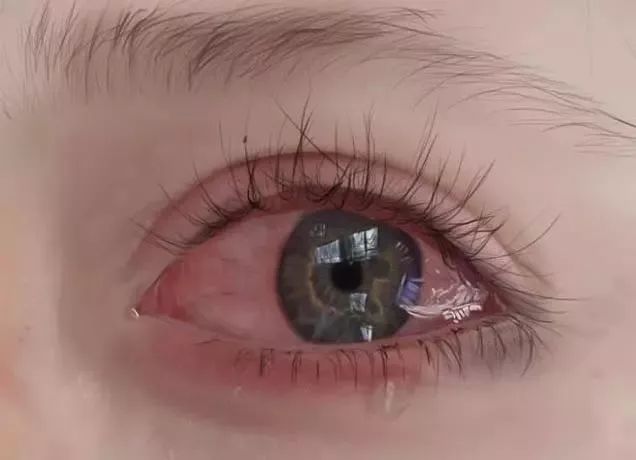 哪只眼睛刚哭过测出你这些年受过的委屈