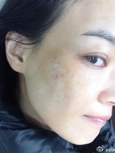 舒淇晒素颜雀斑图片 网友:好单纯好不做作的女神