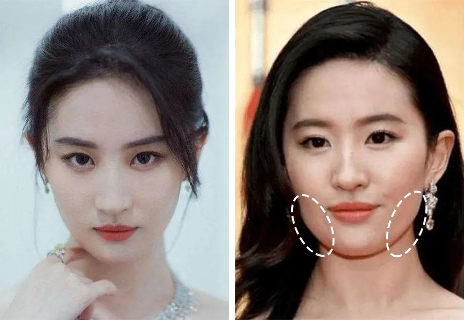 发腮对女生颜值影响有多大