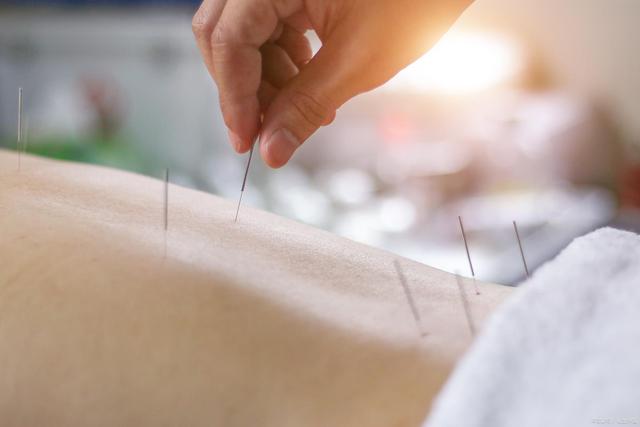 慢性腰痛发作起来夜不能寐,怎么办?不妨试着选择针灸缓解