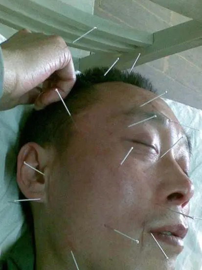 面部_手机_面神经