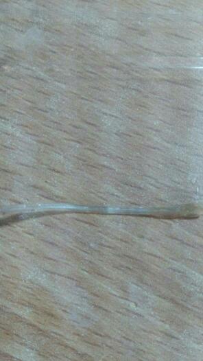 烤鱿鱼套餐里的,这是不是寄生虫啊