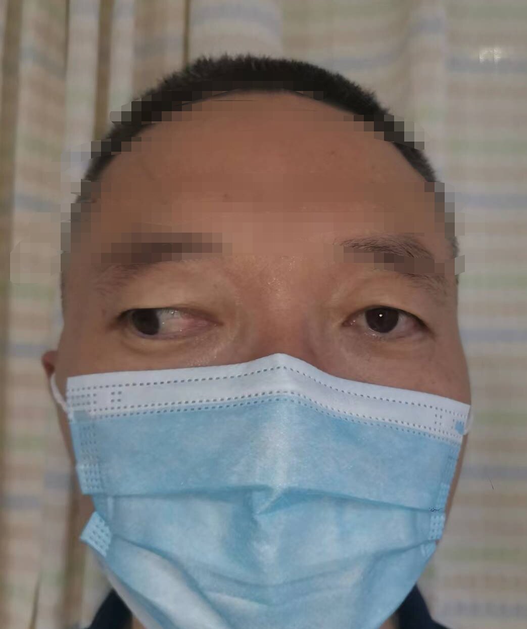 暑假到了, 不少小朋友斗鸡眼,眼位不正,来做手术.