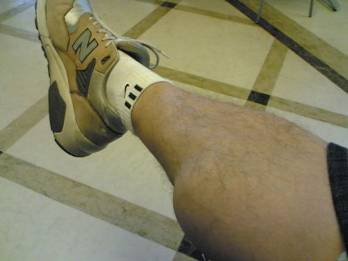 小腿肌(小腿肌肉拉伤最好的治疗方法)