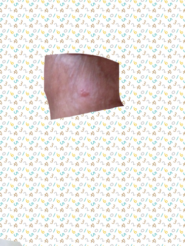 一个大豆豆里有好多小豆豆,像透明的,是什么?