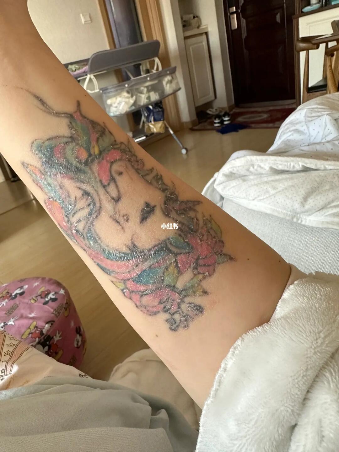 洗彩色纹身第一次全部脱痂了