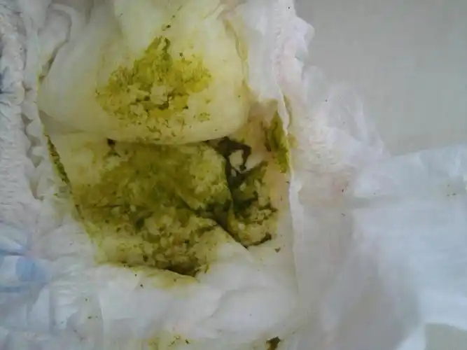 要男孩!宝宝大便发绿"千树万树梨花开"-第2张图片-凯飞博客