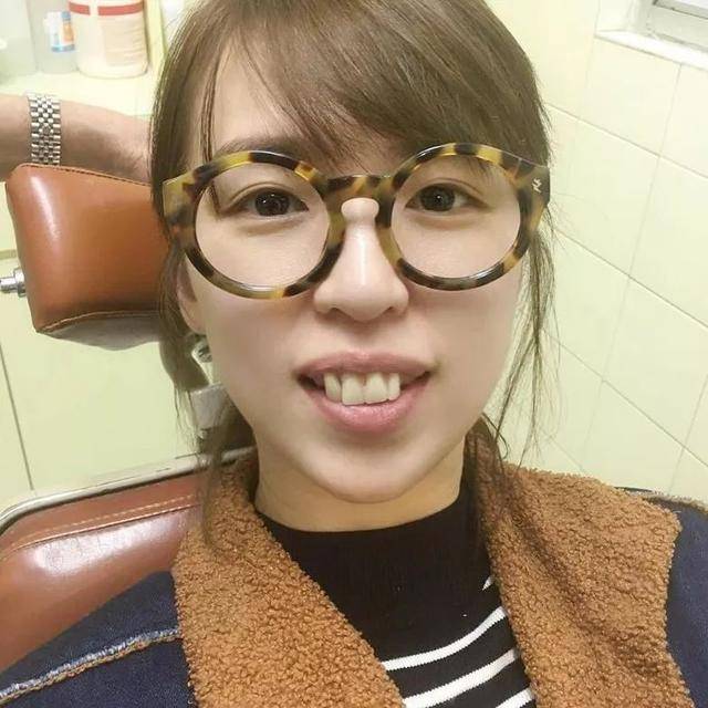 tvb小花为拍新戏扮丑角 龅牙造型获网民激赞:太可爱了!_手机搜狐网