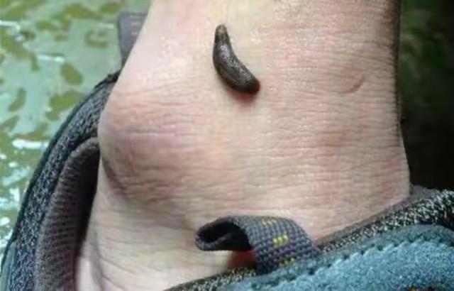 在农村我最怕的就是两种蚂蟥,一种山蚂蝗,也称之旱蚂蝗,一种农田水沟