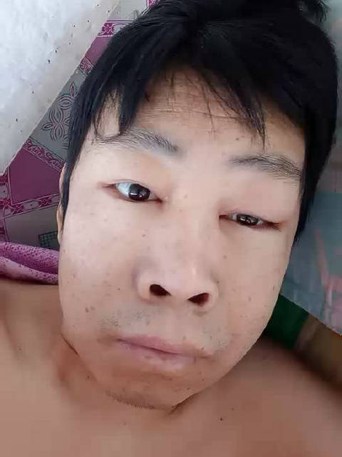 c  关注 肿瘤哥雨来  7月2日 17:35 来自 荣耀