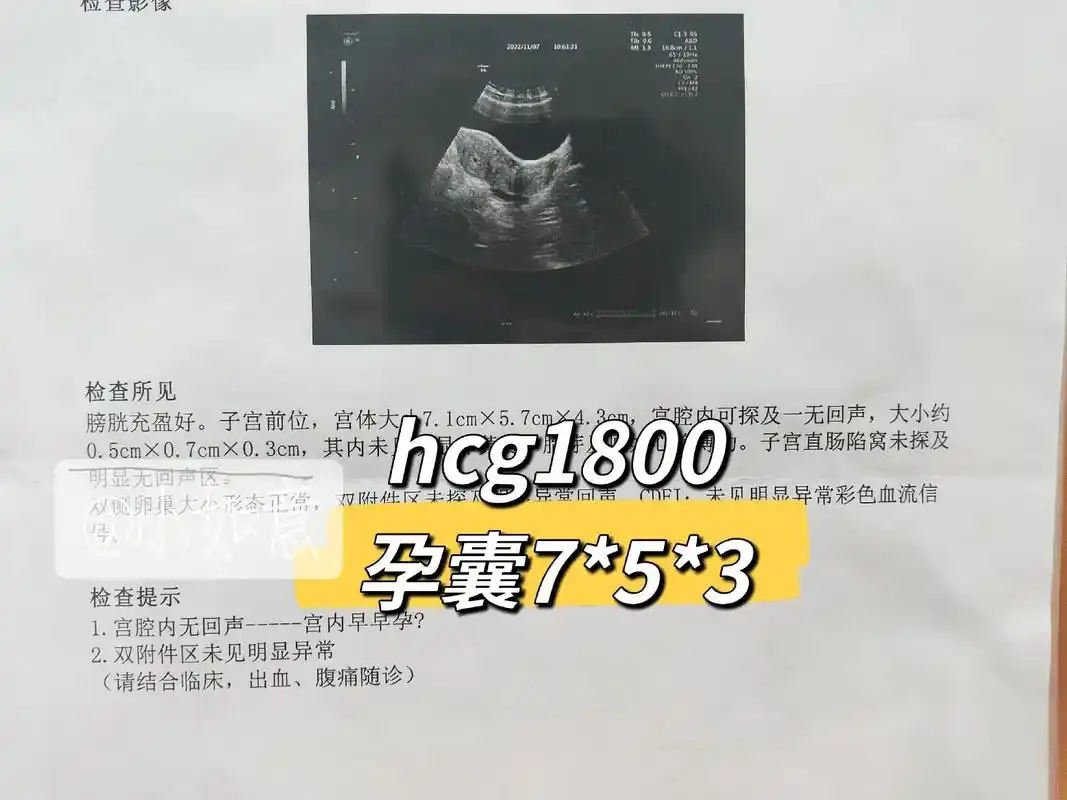 明天就要八周了,太多人问我胎心了.我能说什么,抖音上动不动就 - 抖音