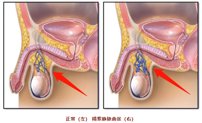 首先,正常的「蛋蛋」什么样?