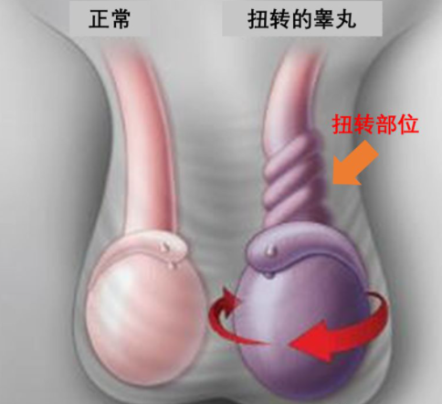 男人应该知道的几个关于"蛋蛋的问题"