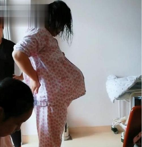 孕妈晒"悬浮肚"走红,人人说是双胞胎,孕妈遭遇让人心疼又担心