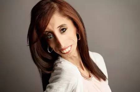 世上最丑的女人又如何,至少她有勇气面对自己