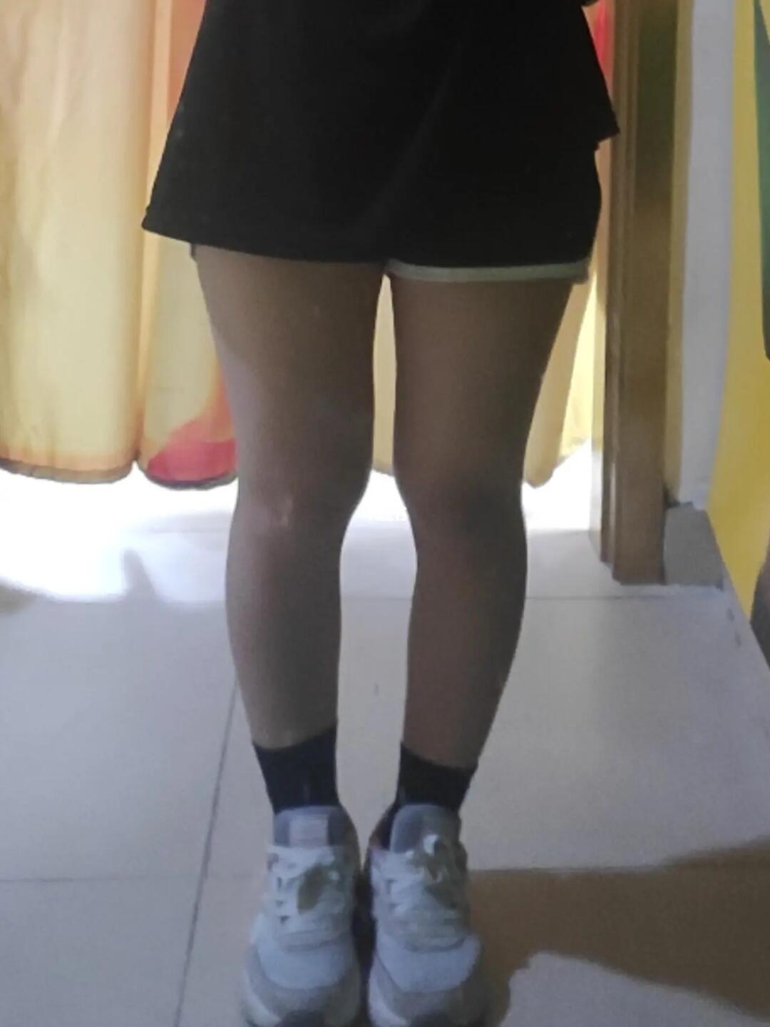 这个腿型怎么改善啊05