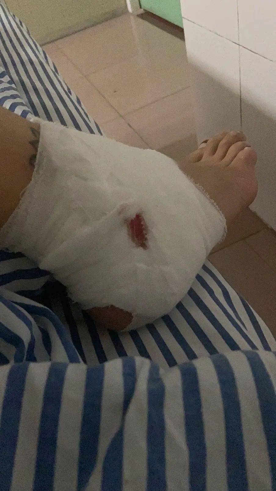 深夜飙车市民发帖凌晨时分在步行街竟被撞伤