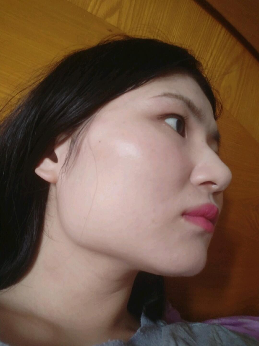 下颌角突出如我,也没几个