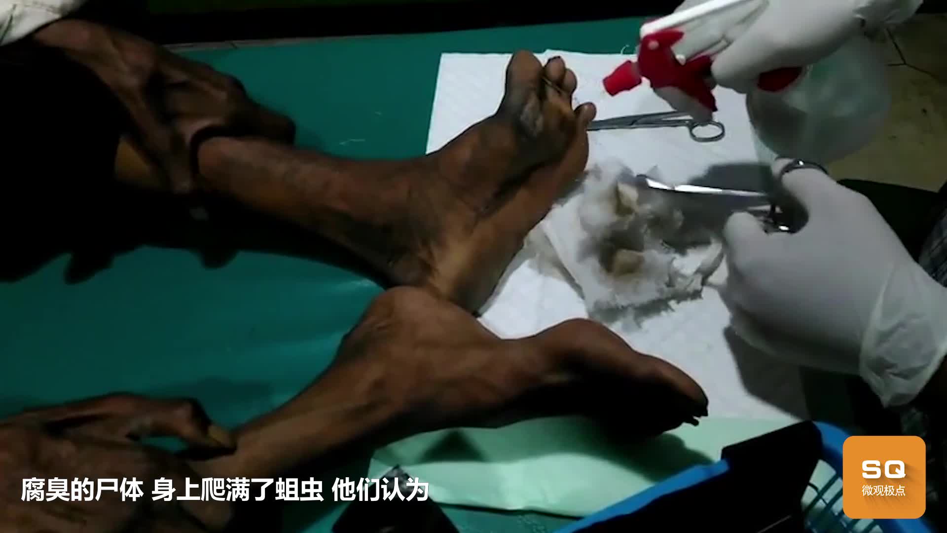 泰国的蛆疗法把蛆放进伤口可以治愈疾病