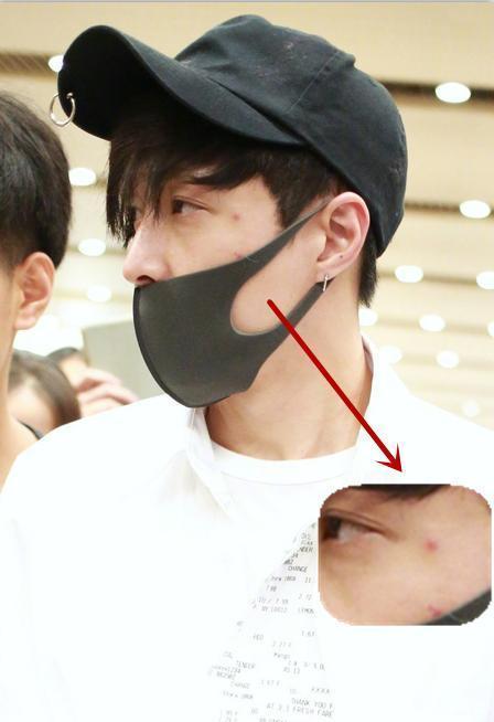 张艺兴"整容式"消痘,重新变成"小绵羊",网友:颜值翻倍涨