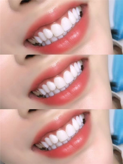 牙齿美白培训中心-金泉网