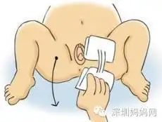 一岁女婴感染阴道炎!夏季宝宝私处感染高发,深圳爹妈请不要再忽视!