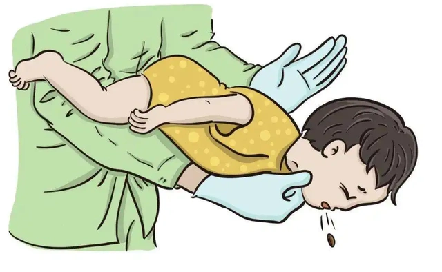 如何应对和预防孩子噎食