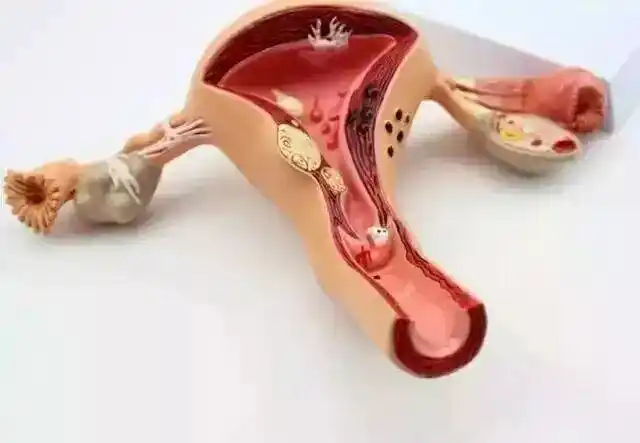 触目惊心的子宫切除术!当一个女人,没了子宫会怎样.